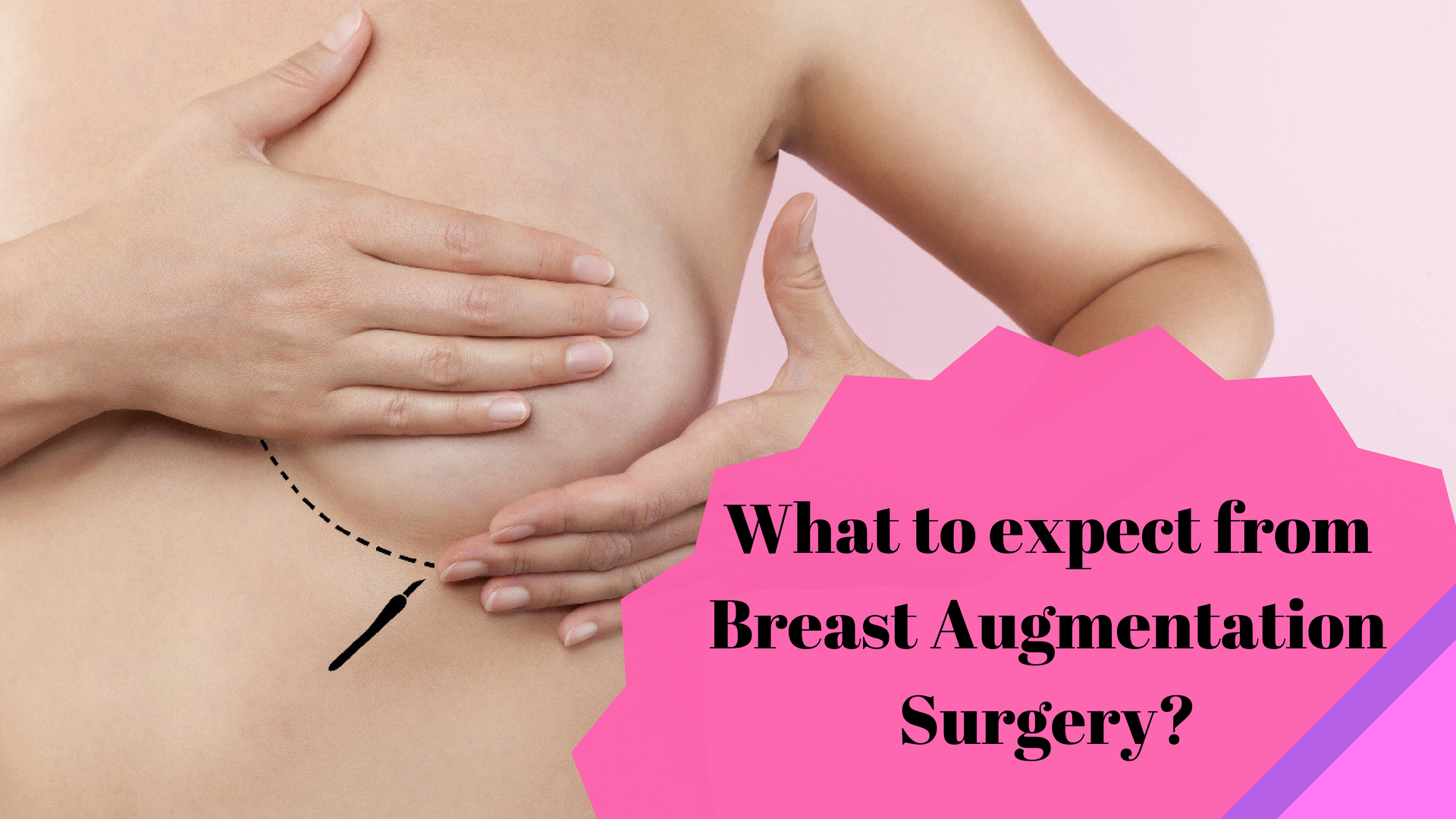 What to expect from breast augmentation Surgery?